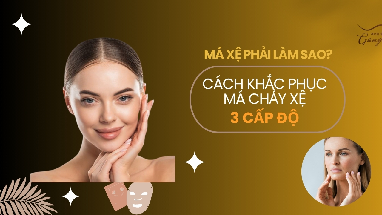 Má xệ phải làm sao?