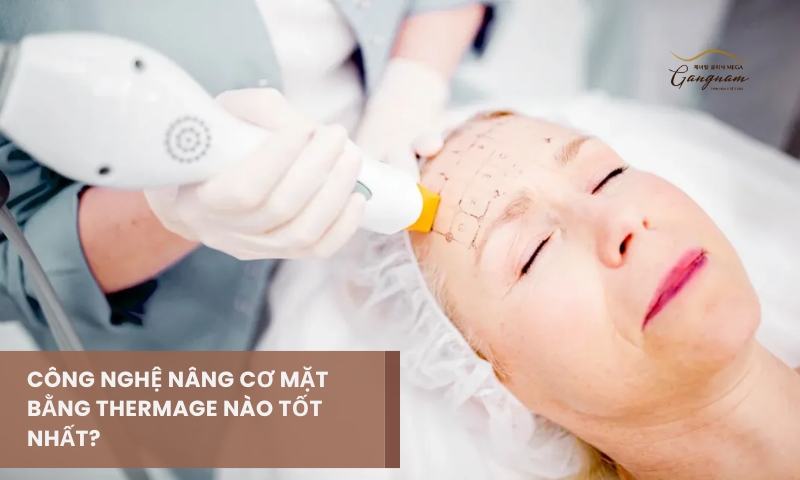 Nâng cơ mặt bằng Thermage công nghệ nào được chuyên gia đánh giá tốt nhất? 