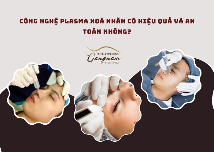 Công nghệ plasma xoá nhăn có hiệu quả và an toàn không?