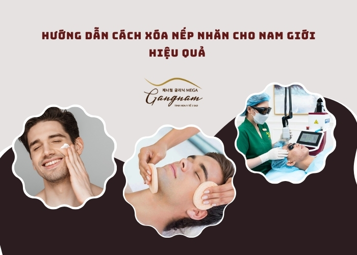 Tổng hợp những phương pháp giúp xóa nếp nhăn cho nam giới hiệu quả