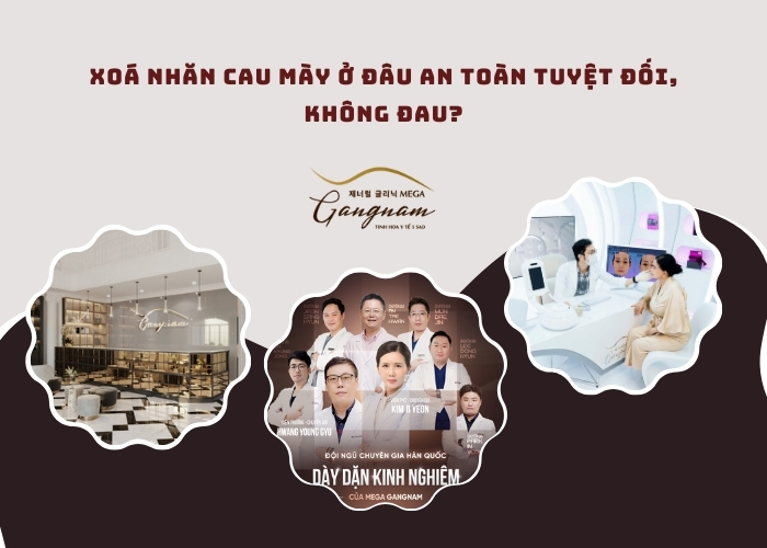 Xoá nhăn cau mày ở đâu an toàn tuyệt đối, không đau?