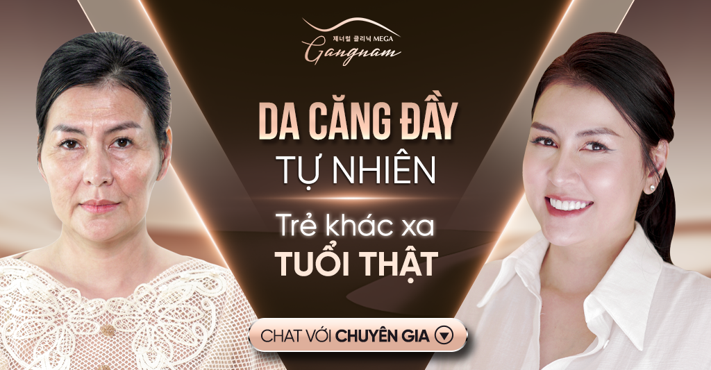 Da căng đầy sau liệu trình nâng cơ mặt tự nhiên Meta Elite