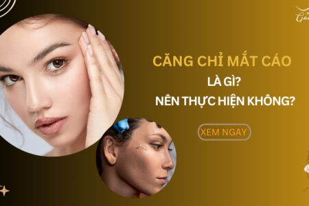 Căng chỉ mắt cáo là gì?