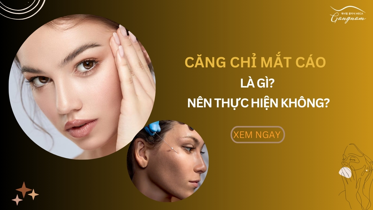 Căng chỉ mắt cáo là gì?