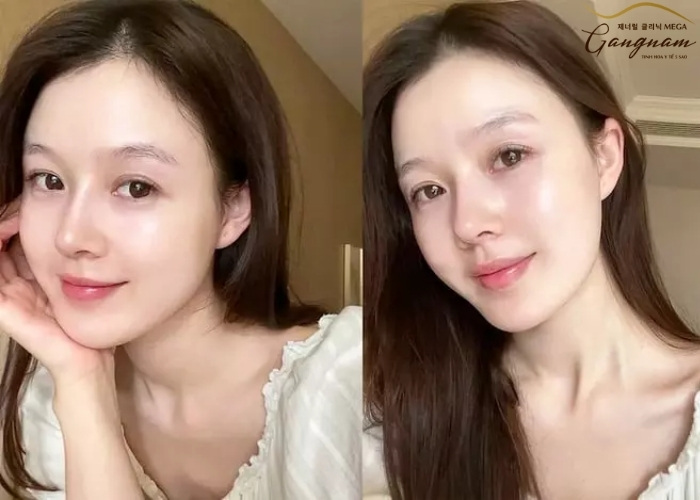 Collagen tươi của Nga có gì khác so với Collagen thông thường