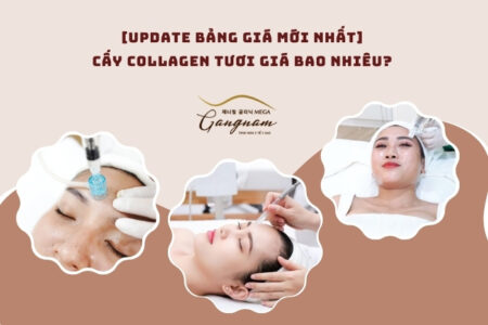 Cấy collagen tươi giá bao nhiêu?