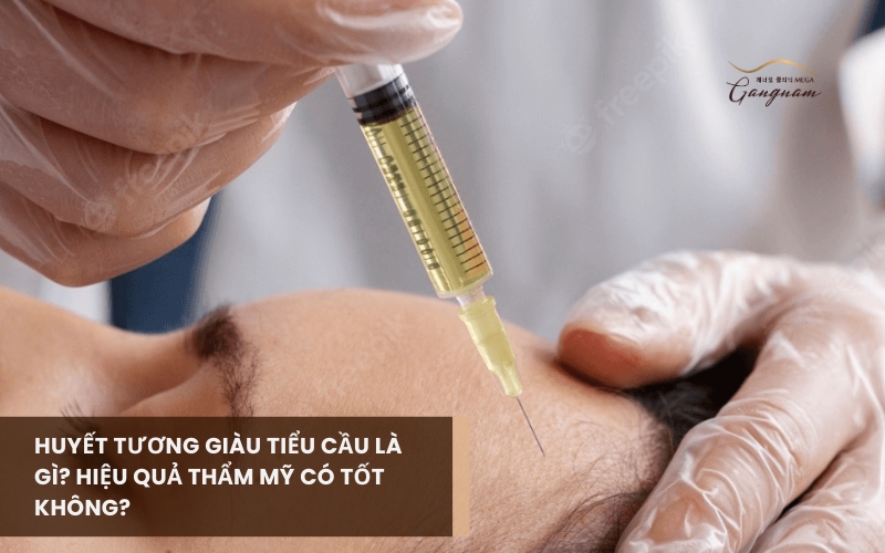 Giải đáp huyết tương giàu tiểu cầu là gì và có những lợi ích như thế nào đối với y tế, thẩm mỹ 