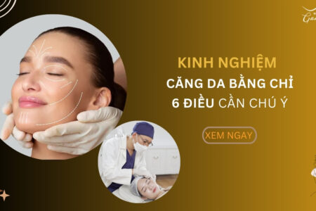 Kinh nghiệm căng da bằng chỉ bạn cần biết