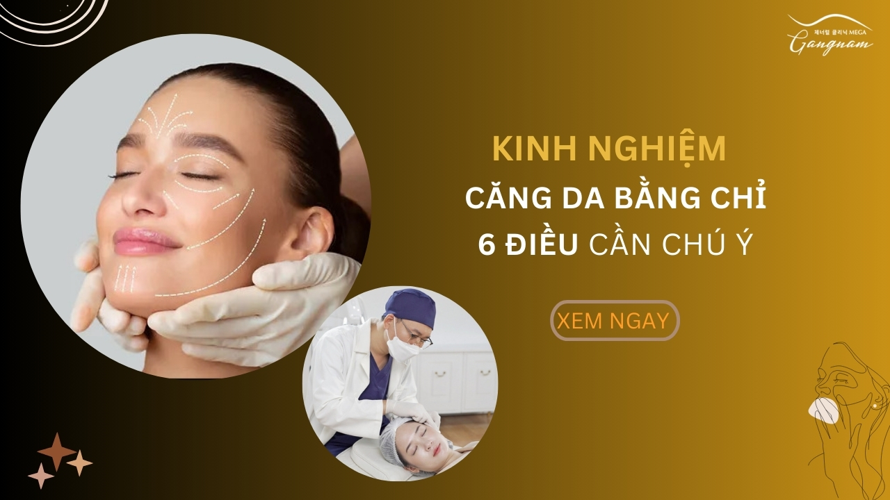 Kinh nghiệm căng da bằng chỉ bạn cần biết