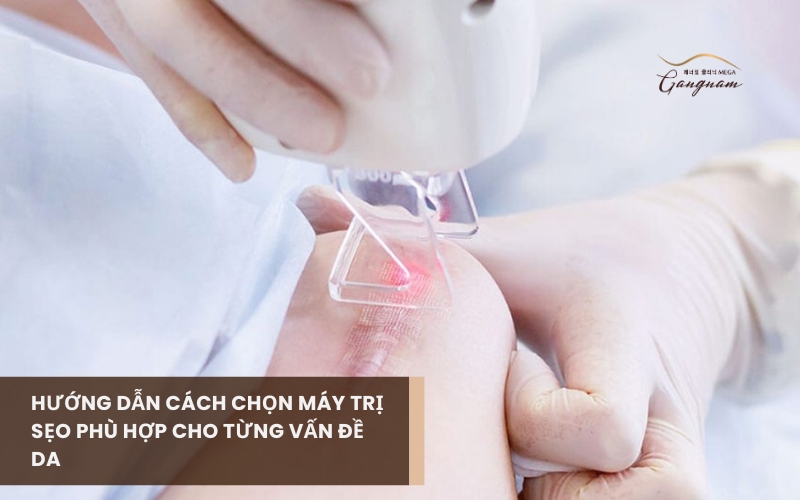 Các loại sẹo khác nhau cần ứng dụng loại máy trị sẹo phù hợp để đạt được hiệu quả tối ưu và an toàn 