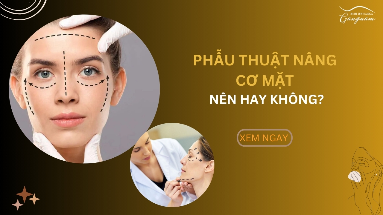 Có nên phẫu thuật nâng cơ mặt hay không?