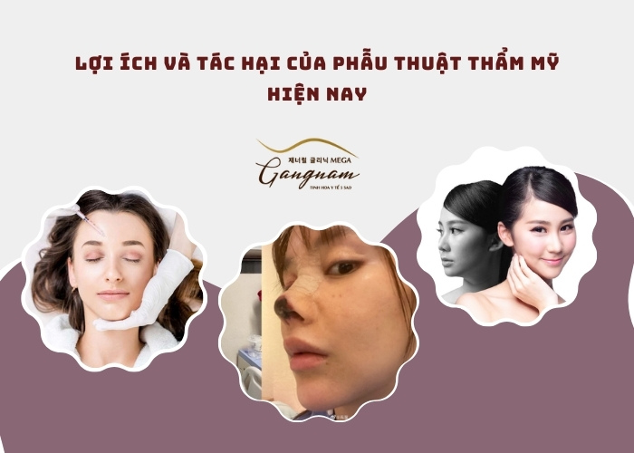 Lợi ích và tác hại của phẫu thuật thẩm mỹ hiện nay