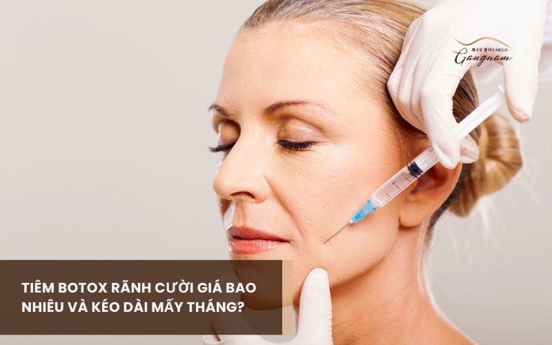 Chi phí tiêm botox rãnh cười bao nhiêu và hiệu quả duy trì được mấy tháng? 