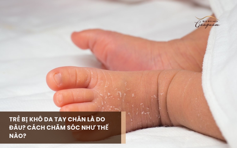 Nguyên nhân gì khiến trẻ bị khô da tay chân? Cách chăm sóc như thế nào và bao giờ nên gặp bác sĩ? 