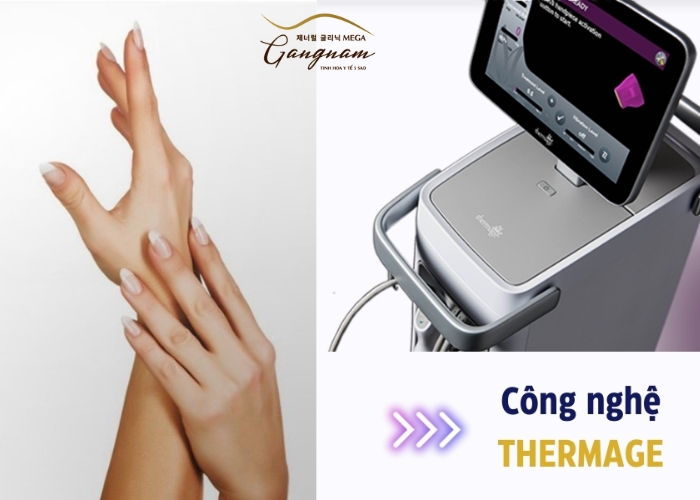 Trẻ hóa bàn tay công nghệ Thermage