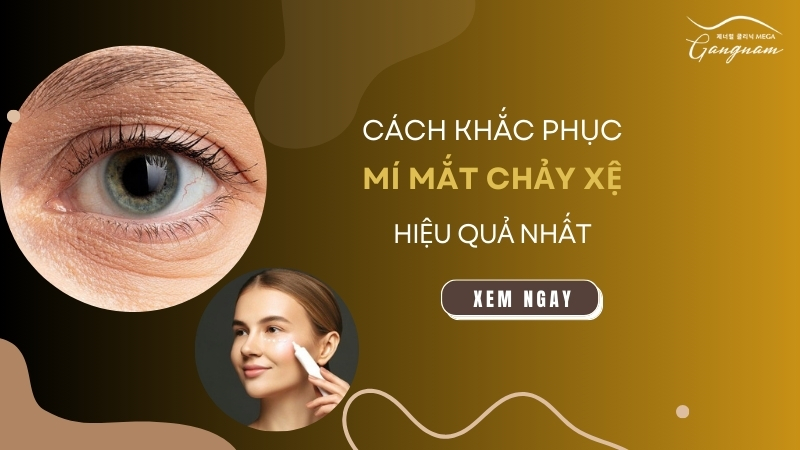 Cách khắc phục mí mắt chảy xệ hiệu quả nhất