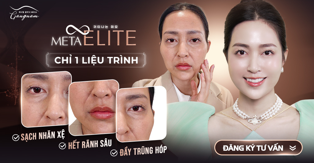 Hiệu quả đẹp toàn diện của Meta Elite trong việc xóa nhăn, nâng cơ, làm đầy vùng da trũng hóp