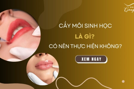 Cấy môi sinh học là gì? Có nên thực hiện không?