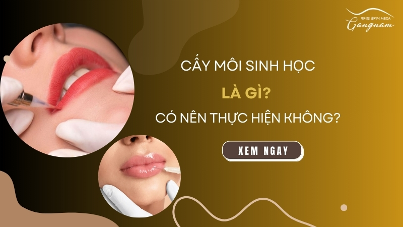 Cấy môi sinh học là gì? Có nên thực hiện không?