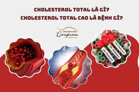 Cholesterol total là gì?