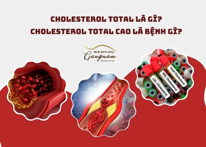 Cholesterol total là gì?