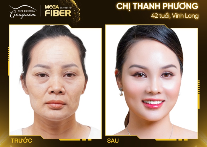 Công nghệ Mega Fiber Plus