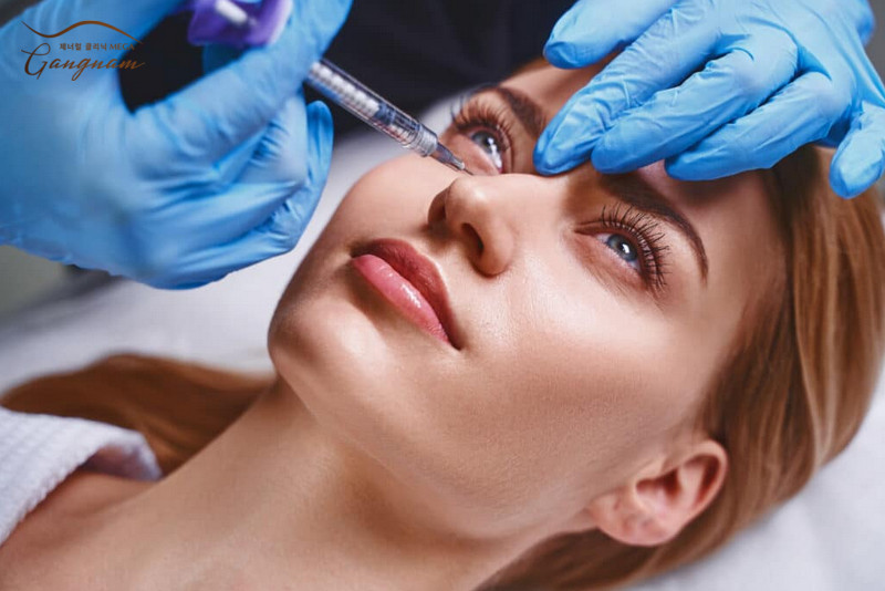 Tiêm botox để thư giãn là ngăn tình trạng co cơ gây ra nếp nhăn 