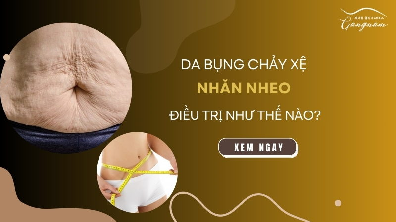 Da bụng nhăn nheo chảy xệ điều trị như thế nào?