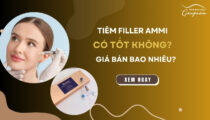 Tiêm filler Ammi có tốt không?