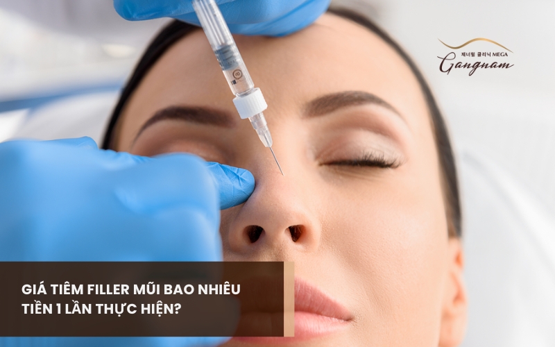 Giải đáp chi tiết giá tiêm filler mũi bao nhiêu tiền 1 lần thực hiện? Có cần tiêm bổ sung hay không? 