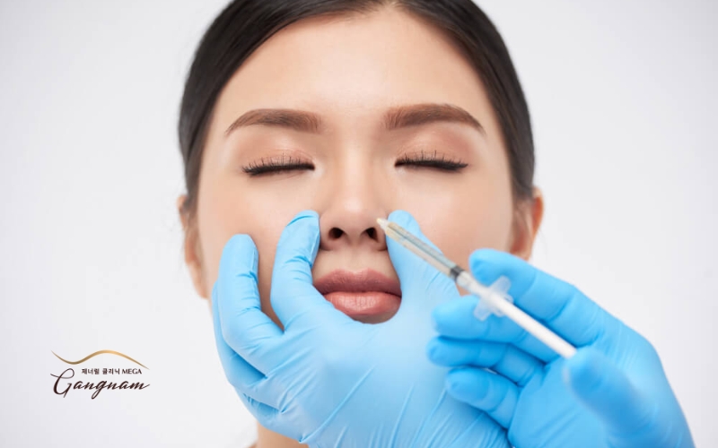 Loại filler, kinh nghiệm của bác sĩ, khả năng đáp ứng của mỗi người có ảnh hưởng đáng kể đến kết quả tiêm mũi