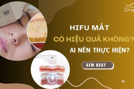 Hifu mắt có hiệu quả không? Ai nên thực hiện?