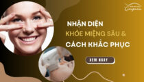 Nhận diện khóe miệng sâu và cách khắc phục hiệu quả