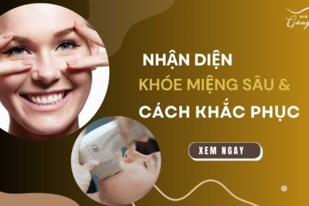 Nhận diện khóe miệng sâu và cách khắc phục hiệu quả