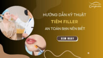 Hưỡng dẫn kỹ thuật tiêm filler an toàn bạn nên biết