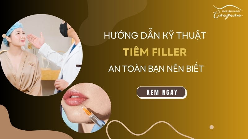 Hưỡng dẫn kỹ thuật tiêm filler an toàn bạn nên biết