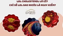 LDL cholesterol là gì?