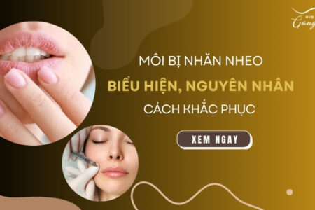 Môi bị nhăn nheo: Biểu hiện, nguyên nhân và cách khắc phục