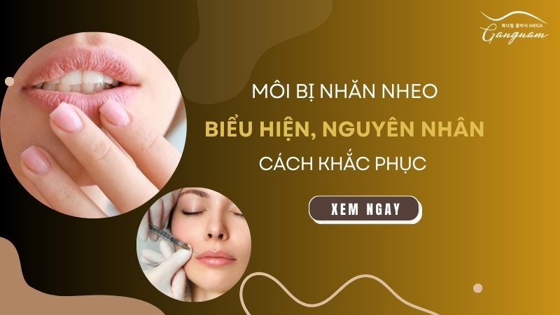 Môi bị nhăn nheo: Biểu hiện, nguyên nhân và cách khắc phục