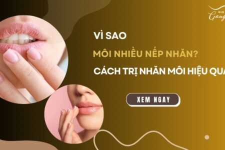 Môi nhiều nếp nhăn vì sao? Cách trị nhăn môi hiệu quả