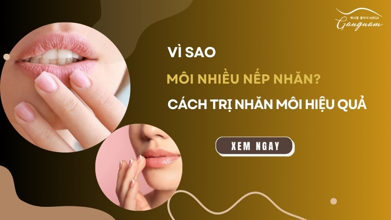 Môi nhiều nếp nhăn vì sao? Cách trị nhăn môi hiệu quả