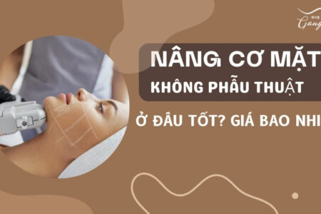 Nâng cơ mặt không phẫu thuật ở đâu tốt? Giá bao nhiêu?