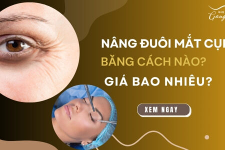 Nâng đuôi mắt cụp bằng cách nào? Giá bao nhiêu tiền