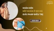 Giải pháp điều trị nếp nhăn ở gò má hiệu quả