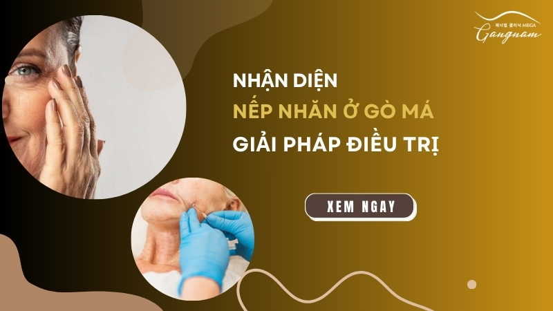 Giải pháp điều trị nếp nhăn ở gò má hiệu quả