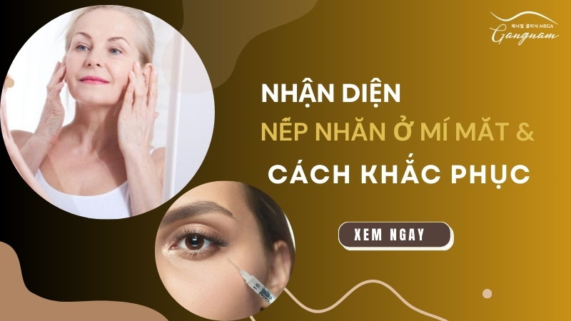 Nhận diện nếp nhăn ở mí mắt và cách khắc phục chi tiết