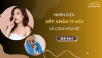 Nhận diện nếp nhăn ở mũi và cách xóa bỏ