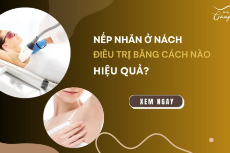 Nếp nhăn ở nách điều trị bằng cách nào hiệu quả?