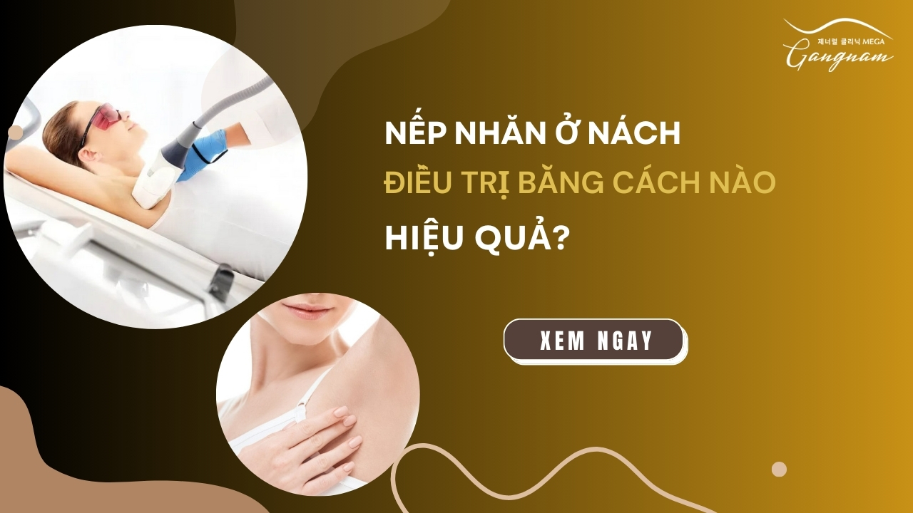 Nếp nhăn ở nách điều trị bằng cách nào hiệu quả?