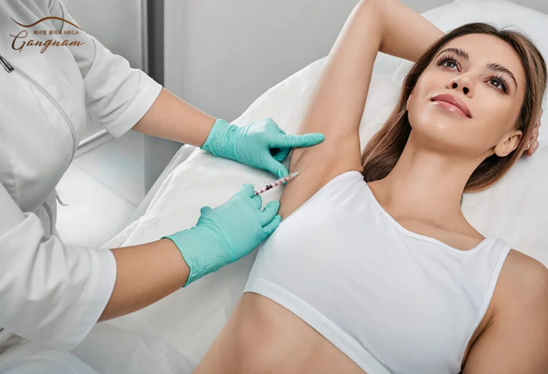 Tiêm giảm nếp nhăn ở nách bằng botox